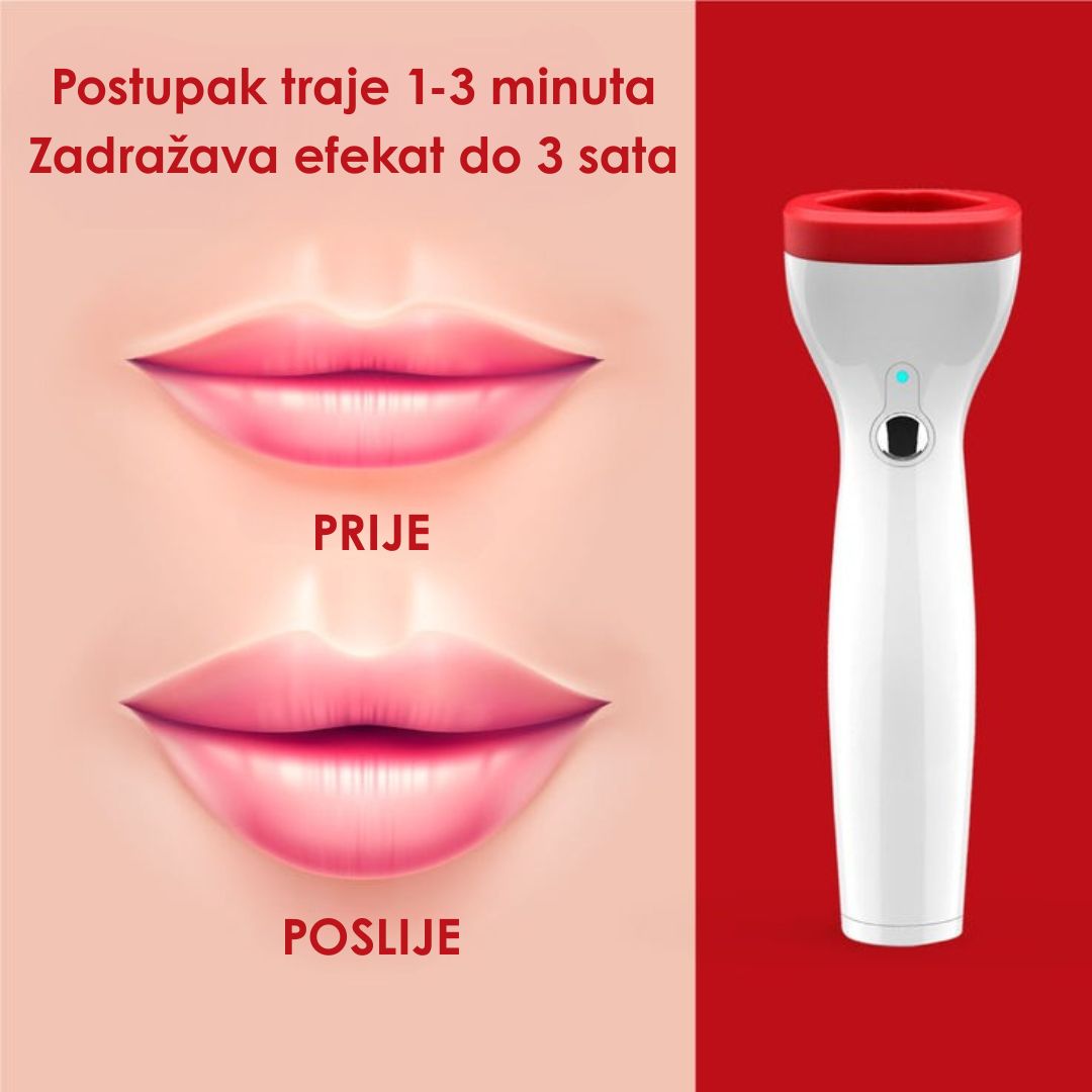 Automatski uređaj za punije usne